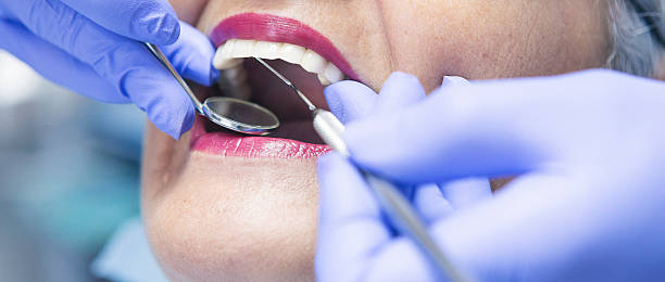 Best Emergency Broken Tooth Repair in Brentwood, MD